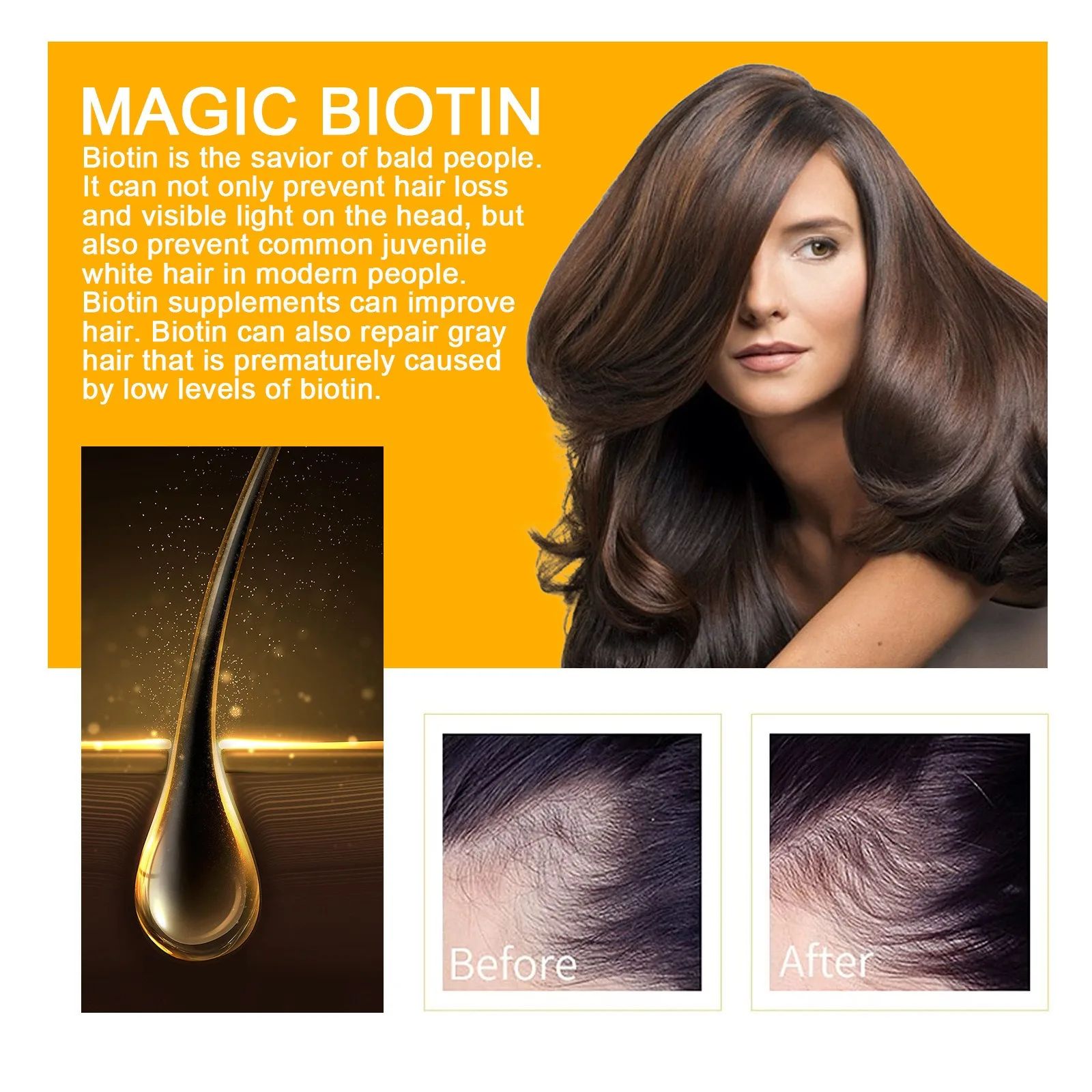 Biotin Fast Hair Growth Products Anti Hair Loss Serum Spray Prevent Baldness Treatment Scalp Beard Beauty Hair Care Product-Hair Serum-Blushia