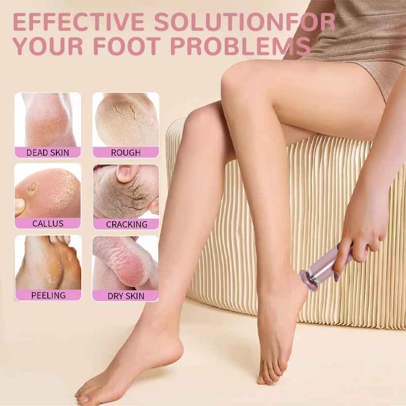 2-in-1 Electric Foot Callus Remover & Nail Polisher – Pedicure & Hand Care Tool-Foot Callus Remover-Blushia