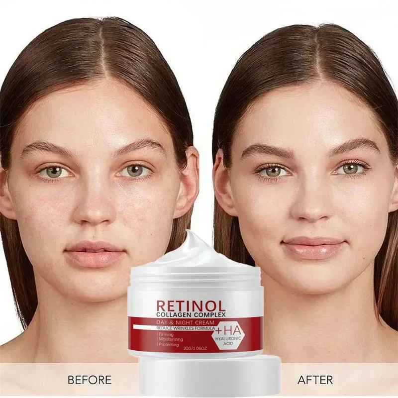 Retinol Whitening Cream for Face & Body – Collagen & Hyaluronic Acid Dark Spot Corrector-Whitening Cream-Blushia