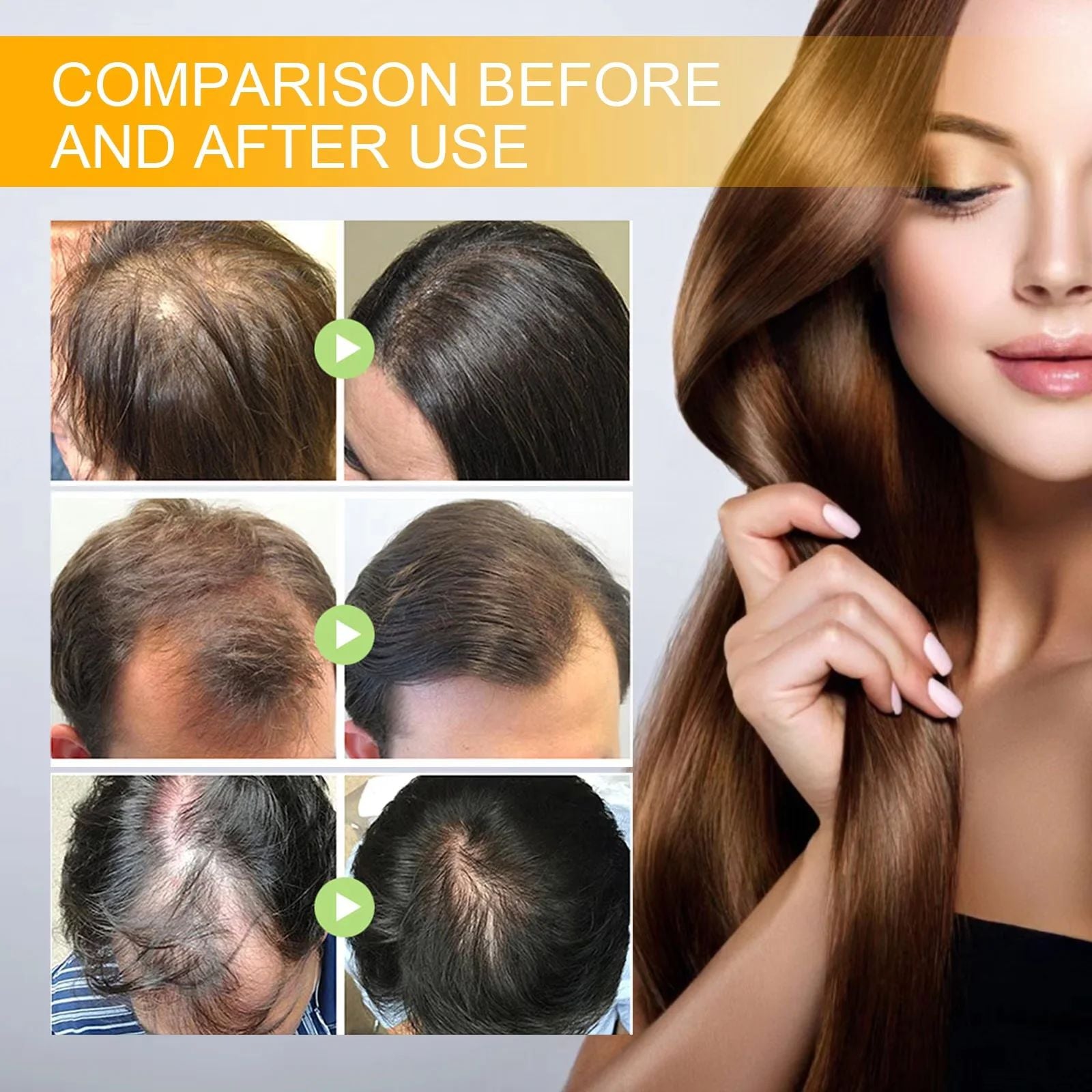 Biotin Fast Hair Growth Products Anti Hair Loss Serum Spray Prevent Baldness Treatment Scalp Beard Beauty Hair Care Product-Hair Serum-Blushia