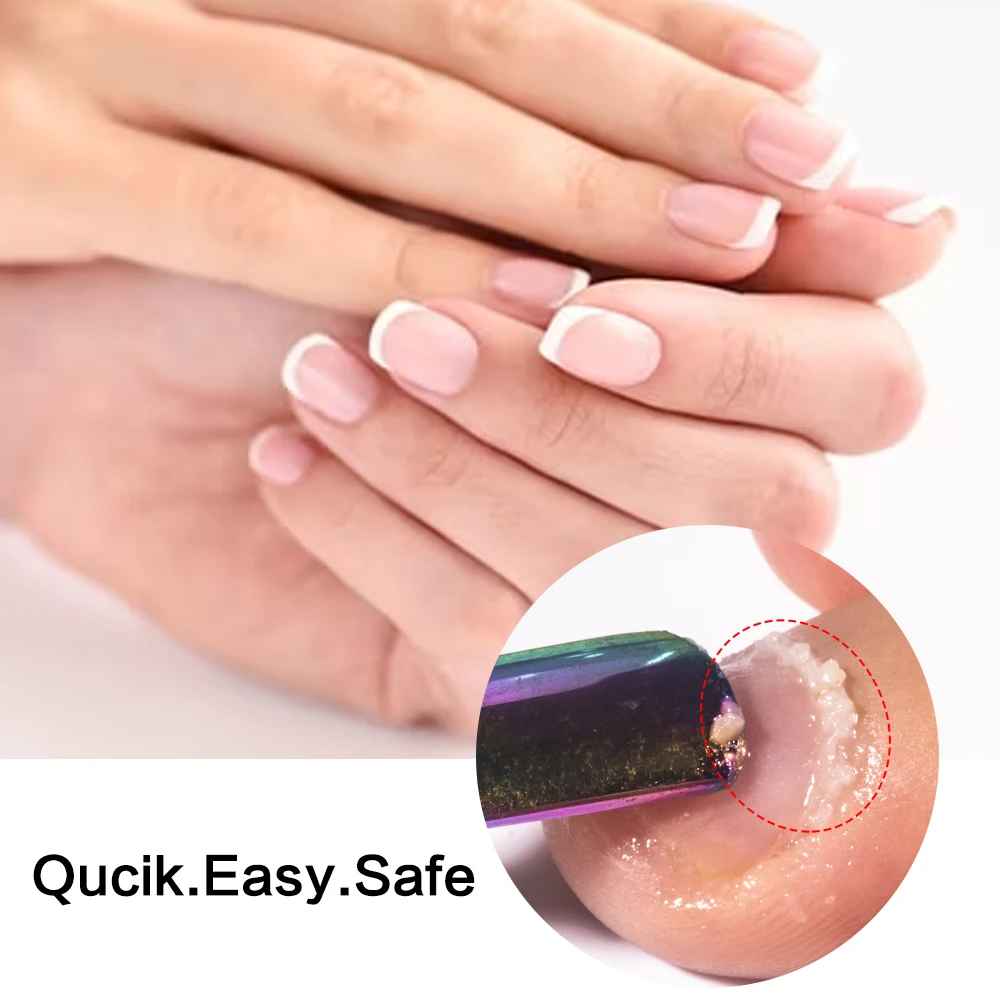 Cuticle Remover Gel 15ML – Nail Cuticle Softener & Manicure Care Treatment-Nail Care & Treatments-Blushia
