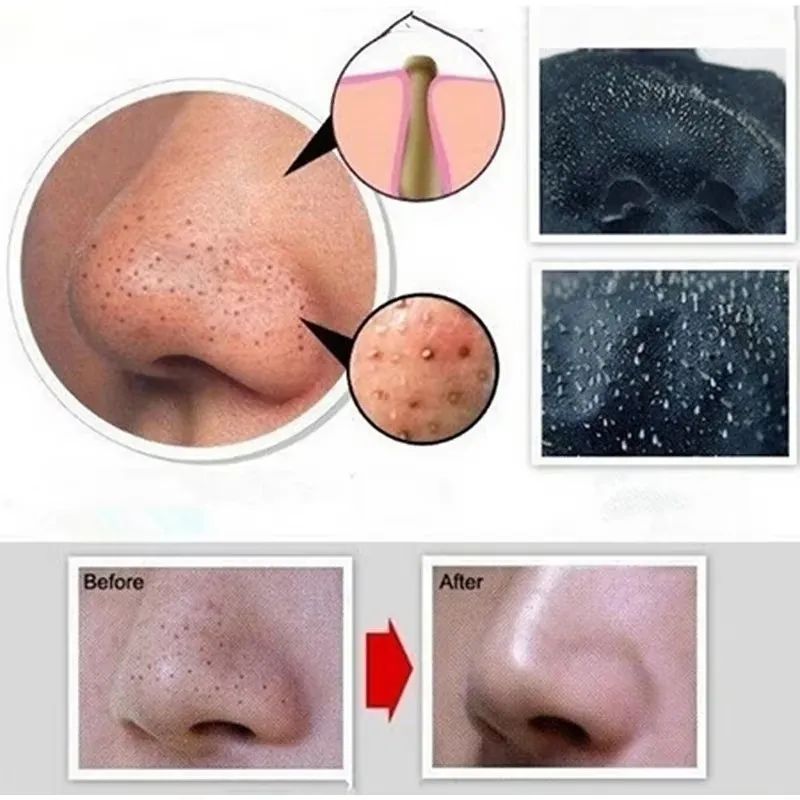 Bamboo Charcoal Blackhead Remover Mask – Pore Tightening Peel-Off Cleanser-Blackhead Remover-Blushia