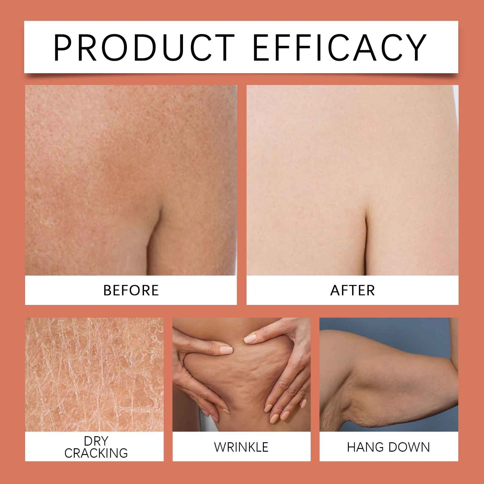 West Month Magic Luxury Body Tightening Oil Deeply Moisturizing Dry Skin Sagging-Body Oil-Blushia