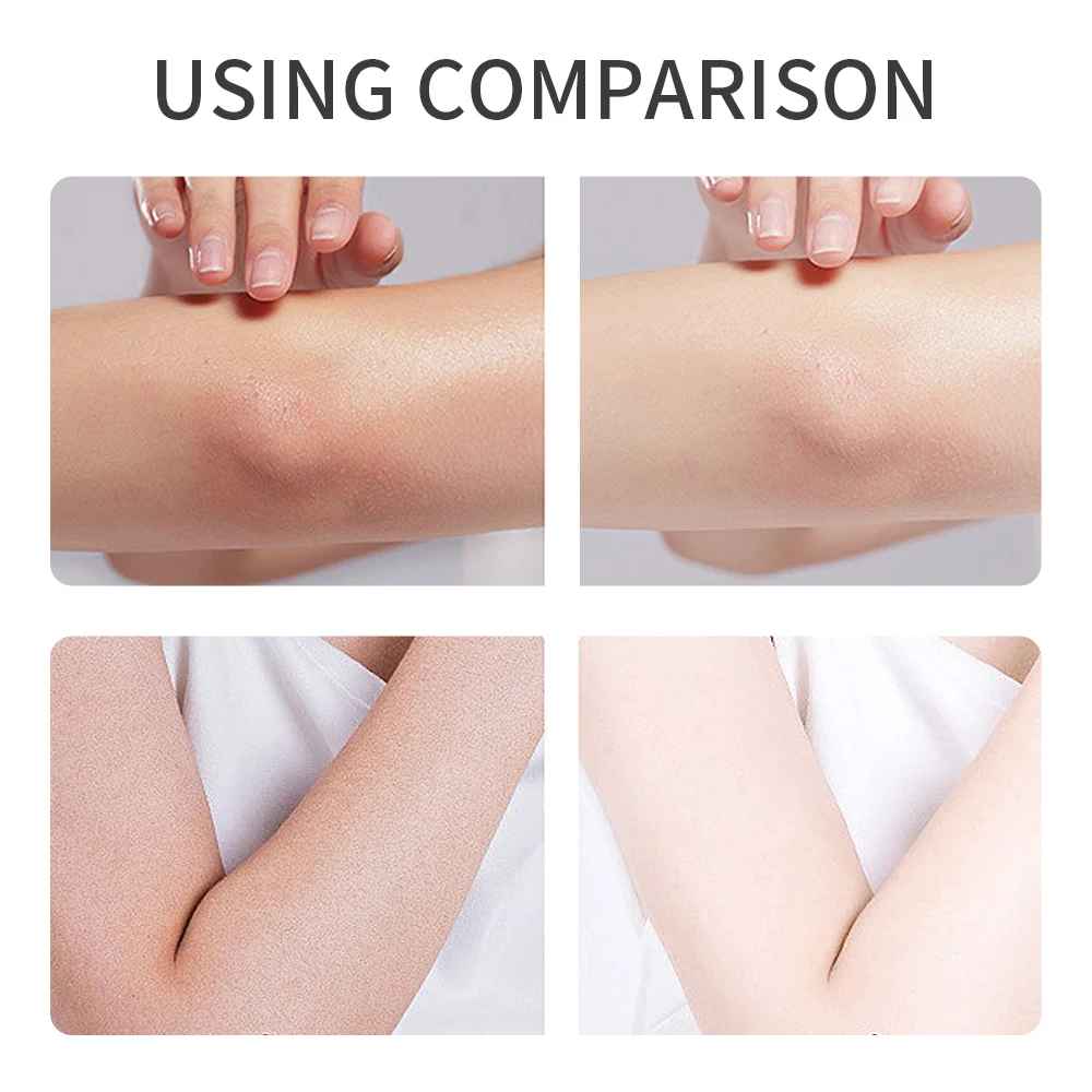 Moisturizing Body Lotion – Hydrating & Nourishing for All Skin Types-Body Moisturiser-Blushia
