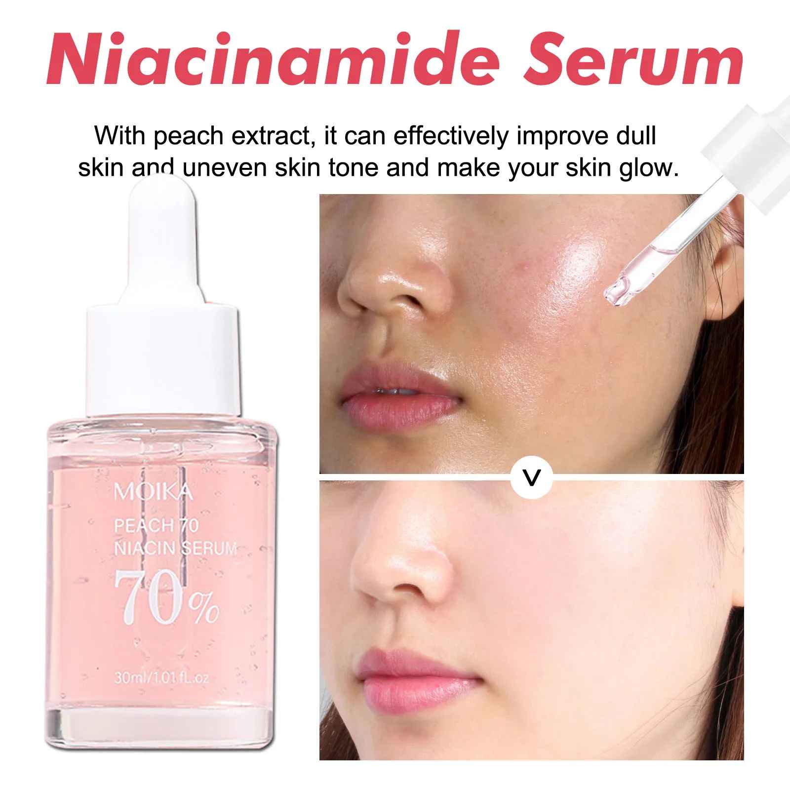 Niacinamide Face Serum – Dark Spot Correcting & Pore Minimizing Care-Face Serum-Blushia
